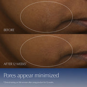 Advanced Night Repair Serum Skincare Set