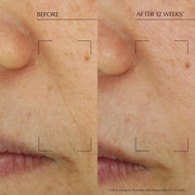 Revitalizing Supreme+